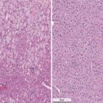 Wilsons disease mouse model
