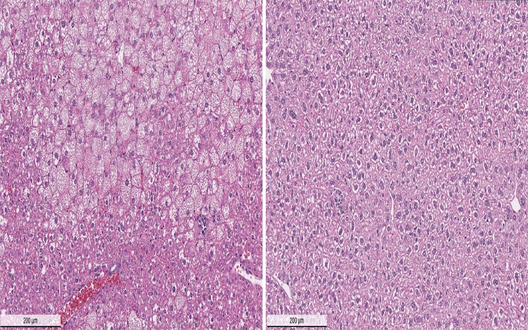 Wilsons disease mouse model