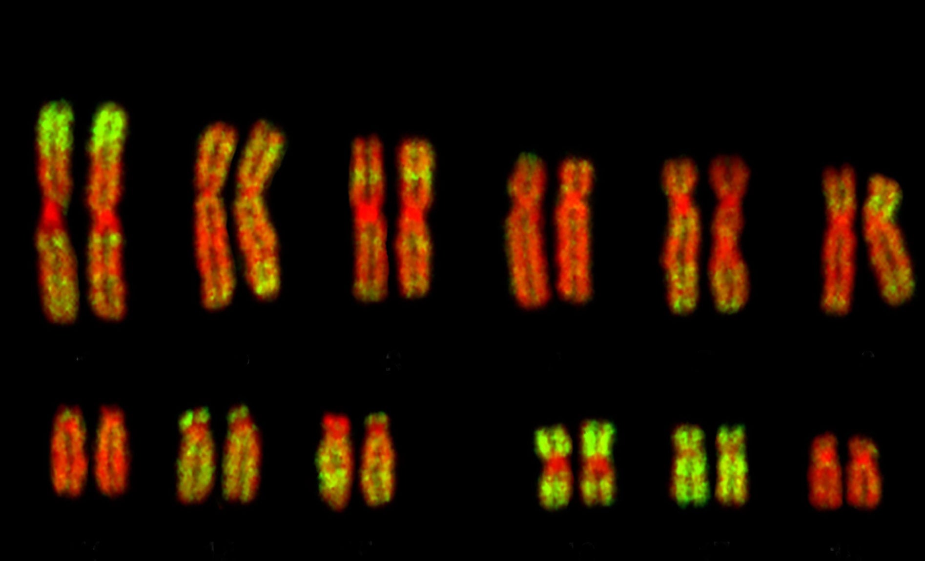 human chromosomes