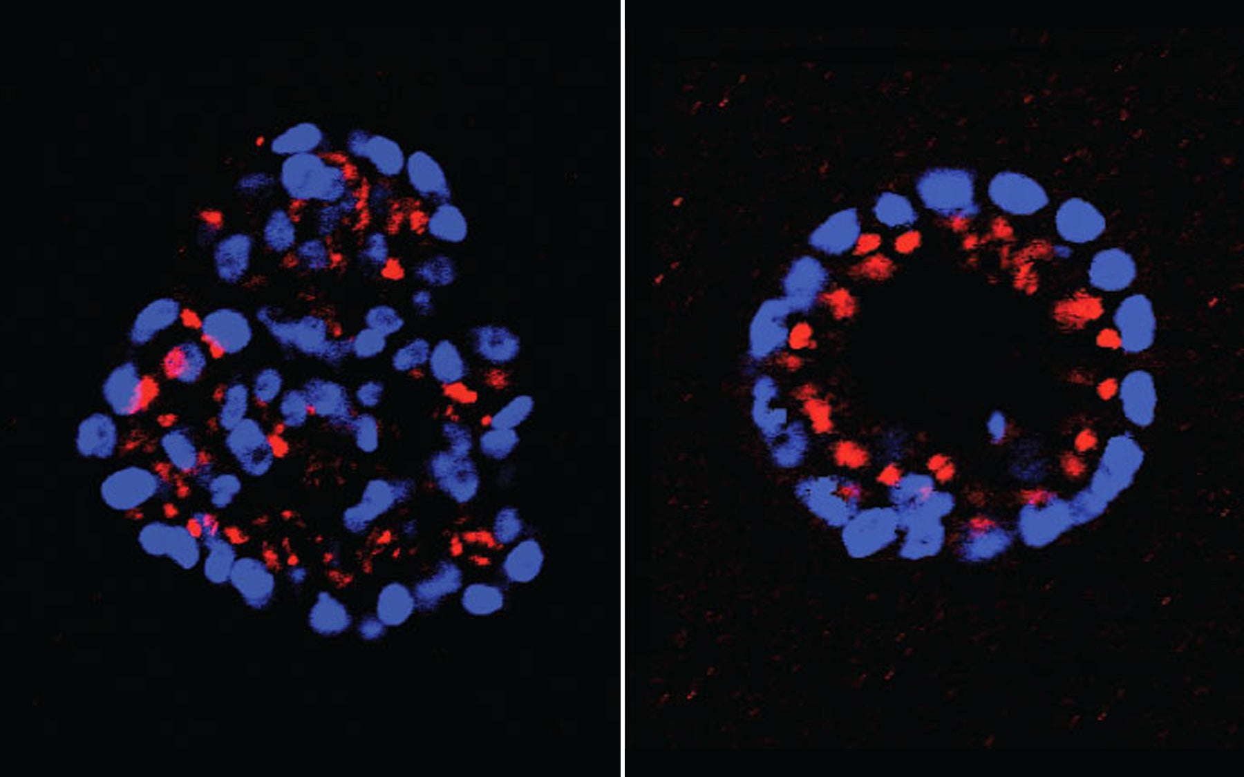 Mammary Epithelial Cells
