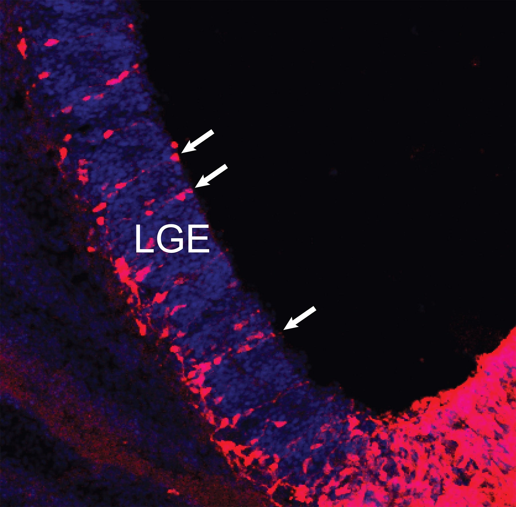 aIP cells