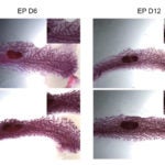 Pregnant hormones breast tissue