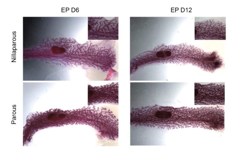 Scientists show the mammary gland ‘remembers’ prior pregnancy, spurring milk production