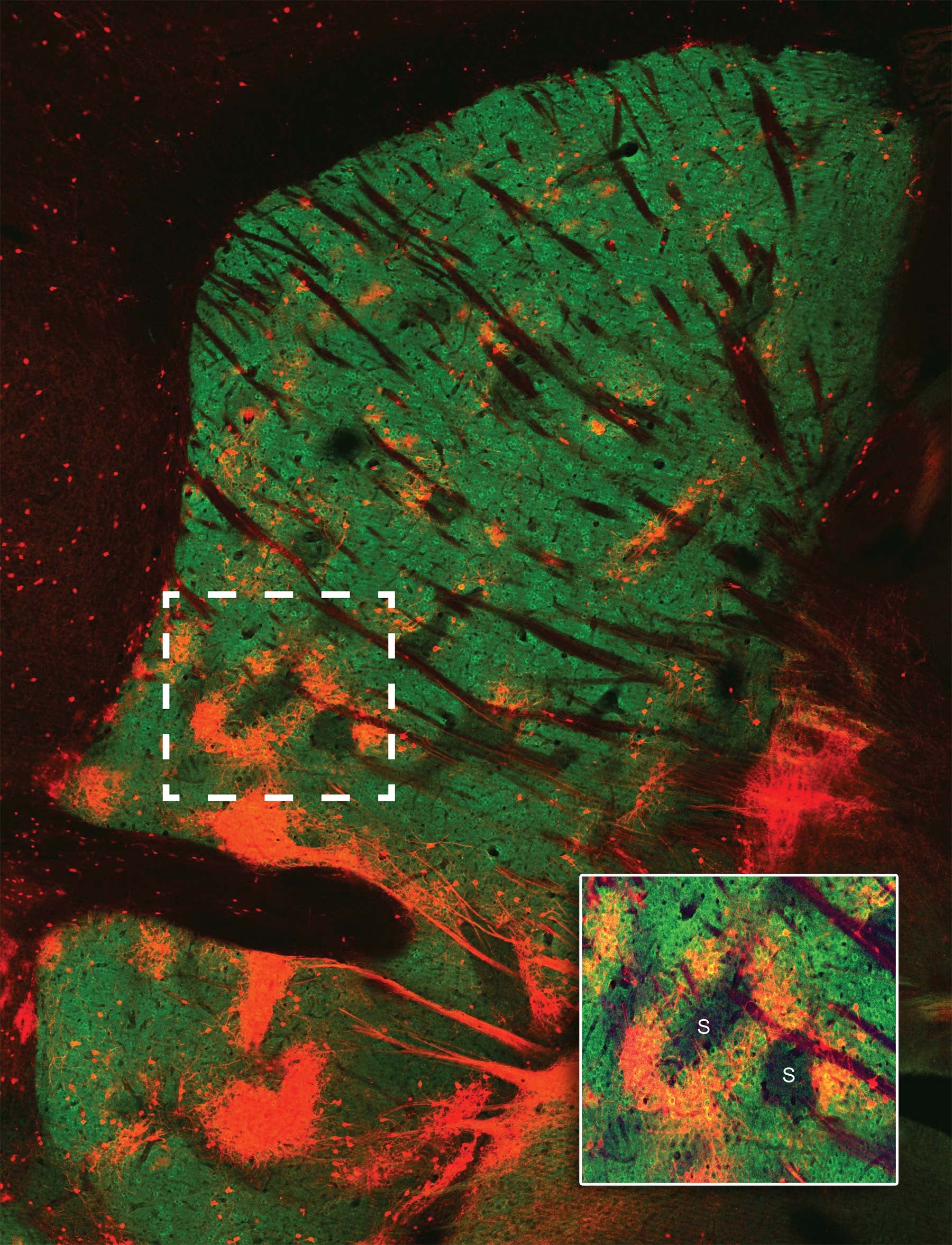 striosome islands