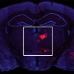 Mouse brain coronal section Bo Li