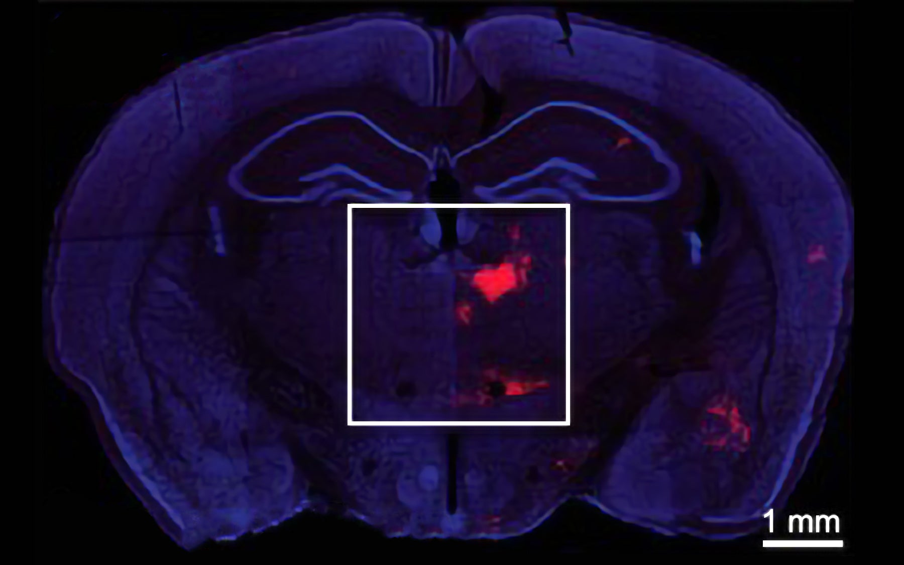 Mouse brain coronal section Bo Li
