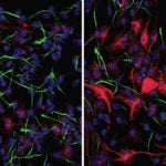 neuronal cells