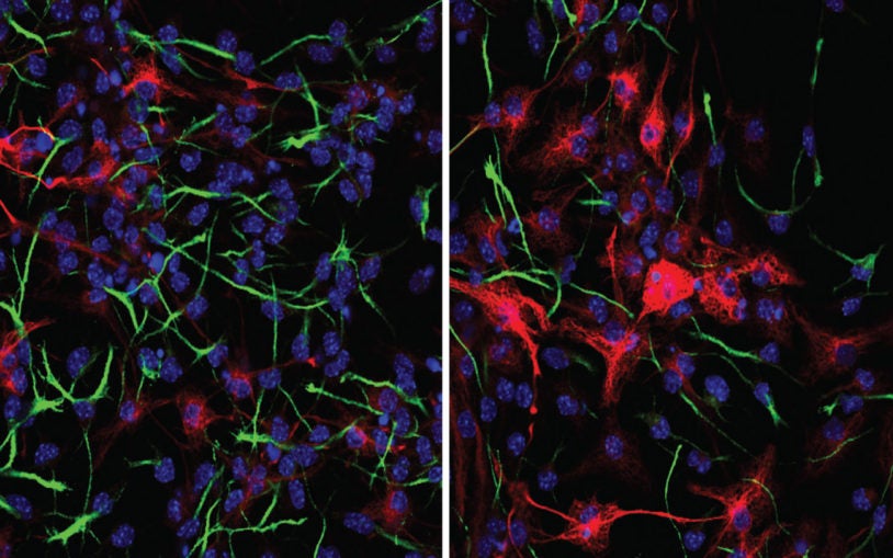 neuronal cells