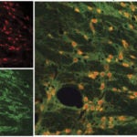 Cortex Thalamus and TRN neurons