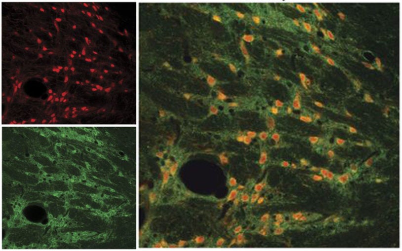 Cortex Thalamus and TRN neurons