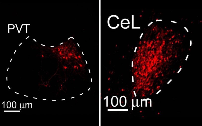 PVT CeL brain regions