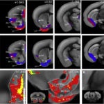 Osten Brain Stimulus