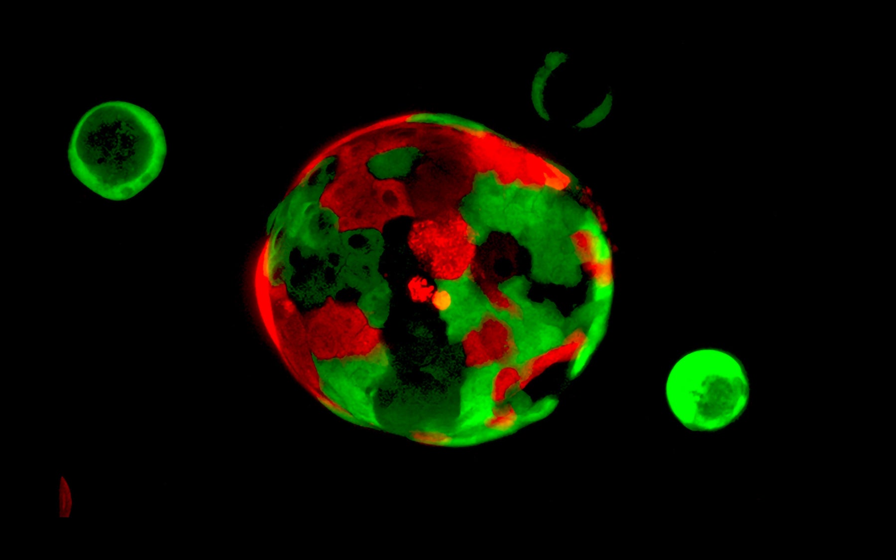 Tuveson pancreatic tissue