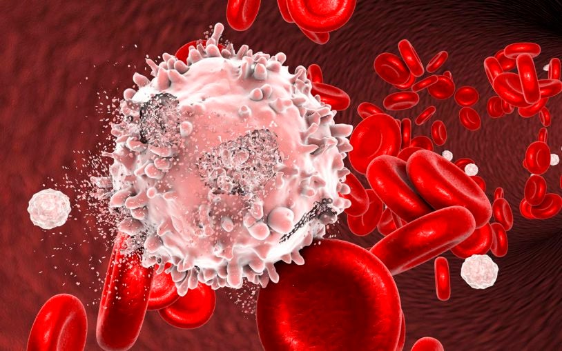 Destruction of leukemia cell