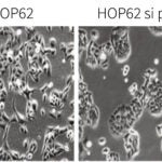 Protein p53-psi HOP62