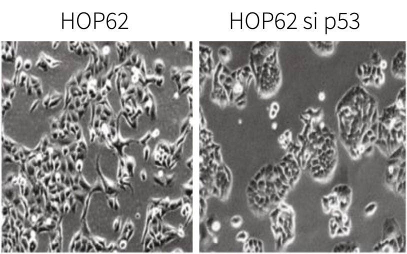 Protein p53-psi HOP62