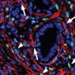 Signaling within a tumors stroma