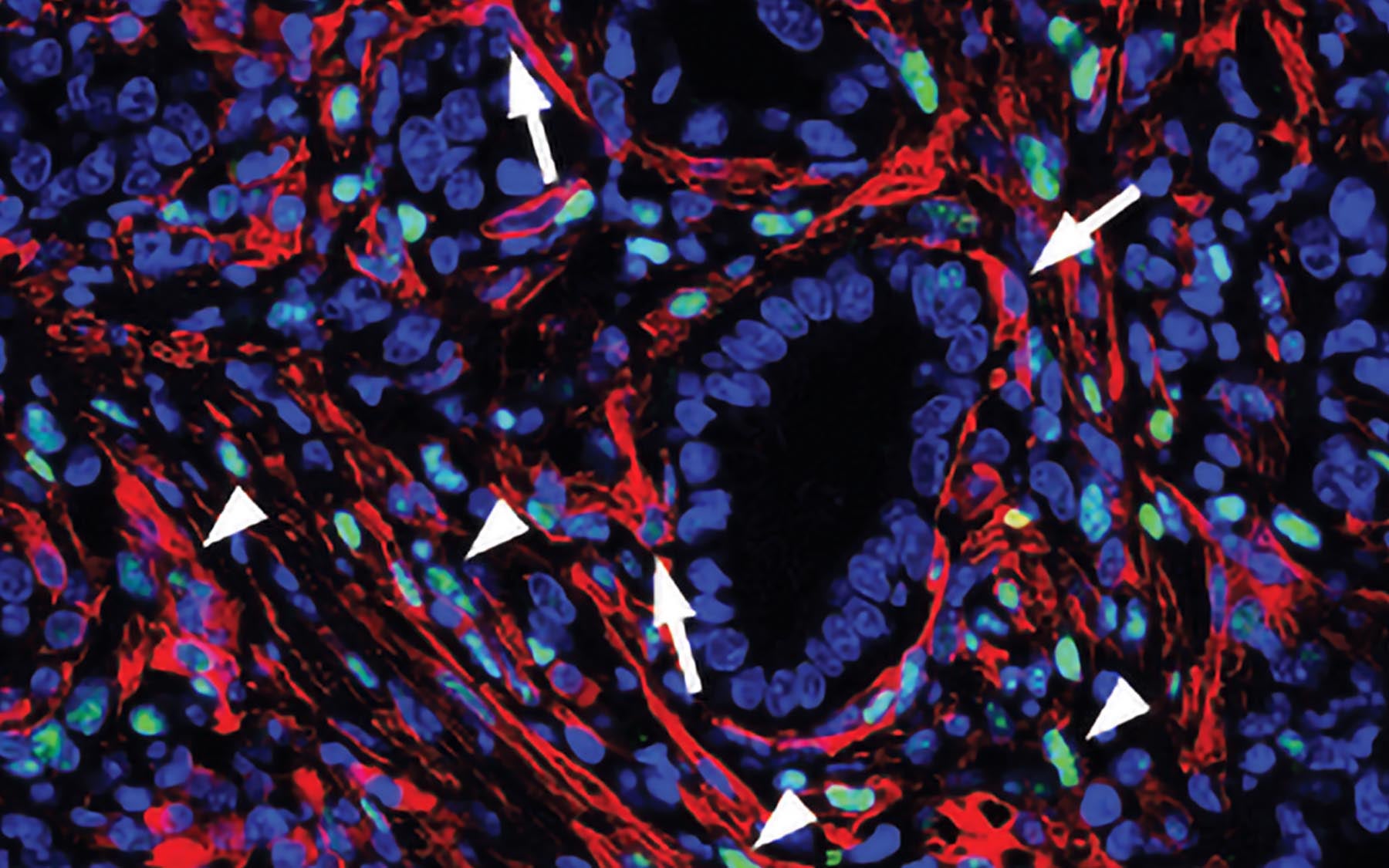 Signaling within a tumors stroma