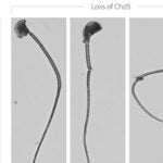 Sperm Chd5 loss