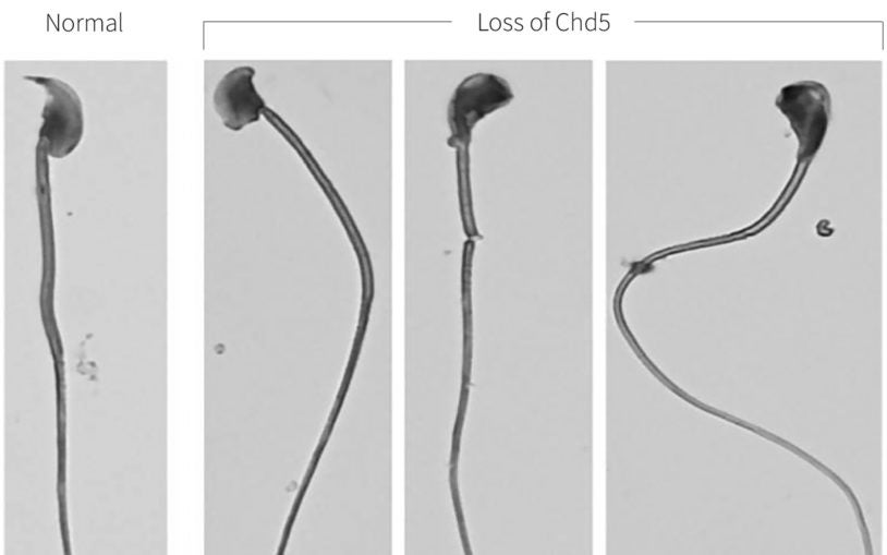 Sperm Chd5 loss