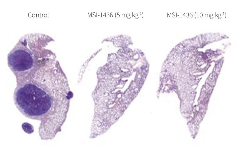 Team reports validation of potentially powerful new way to treat HER2-positive breast cancer