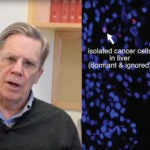 Fearon Pancreatic cancer surgery