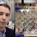 Organoids pancreatic cancer treatment
