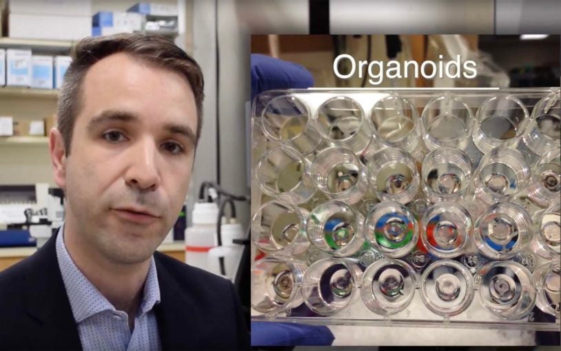 Organoids pancreatic cancer treatment