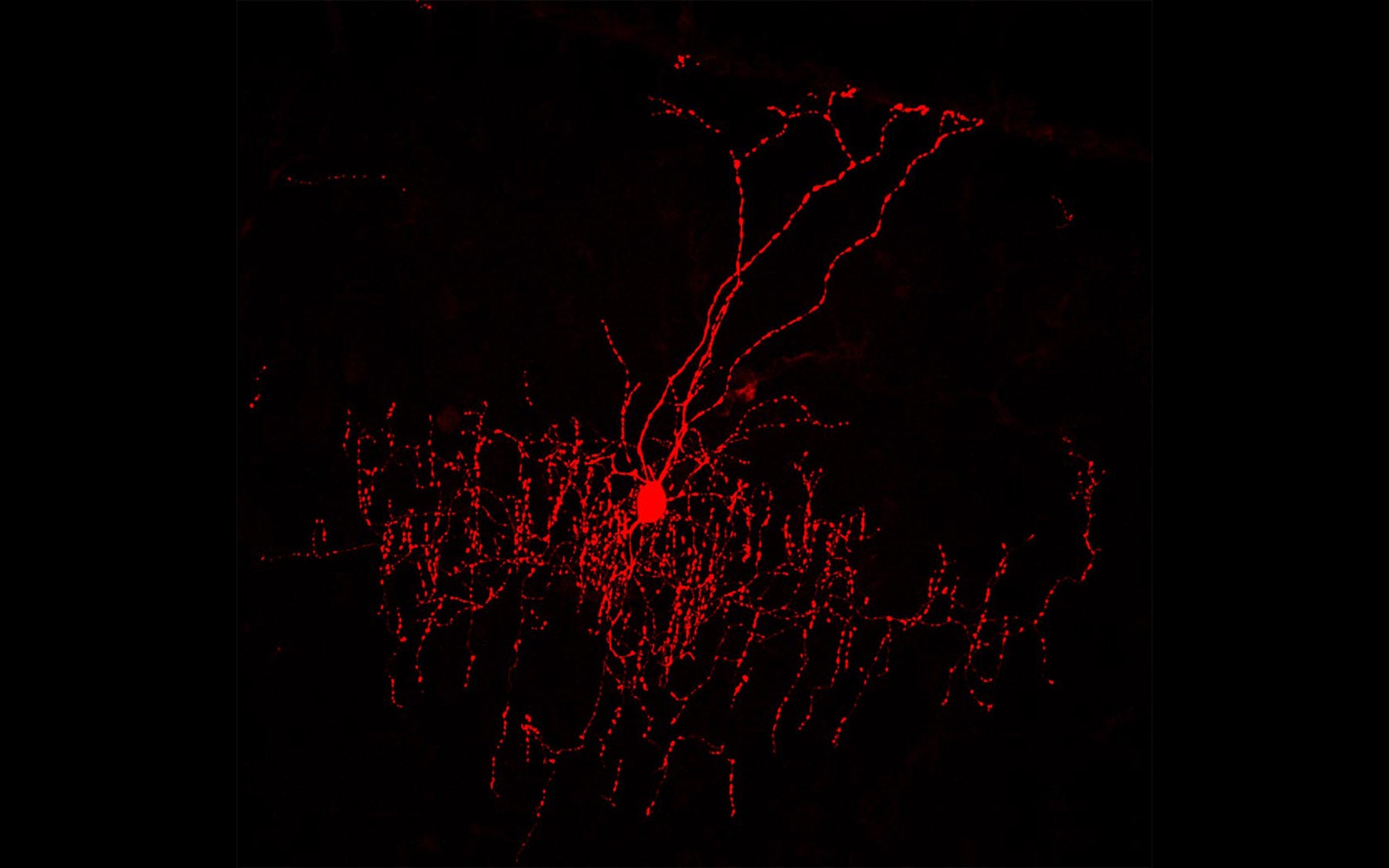 Huang Single chandelier cell