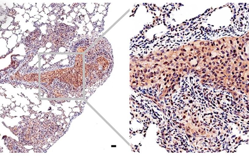 Trotman Myc prostate cancer