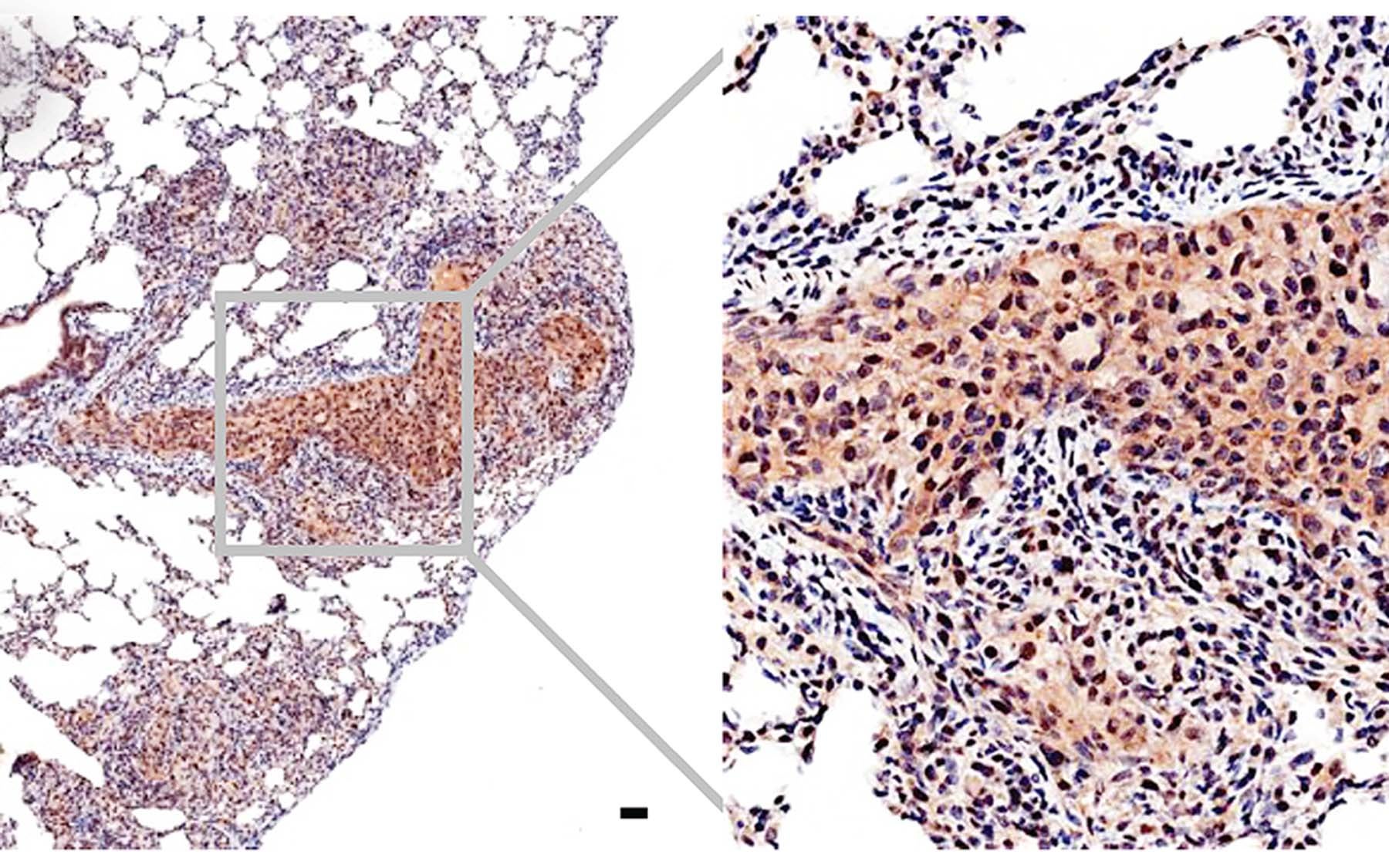 Trotman Myc prostate cancer