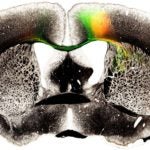 Myelin AAV Combination