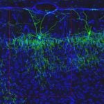 axo-axonic cell mouse brain