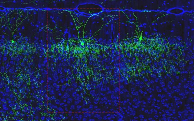 axo-axonic cell mouse brain