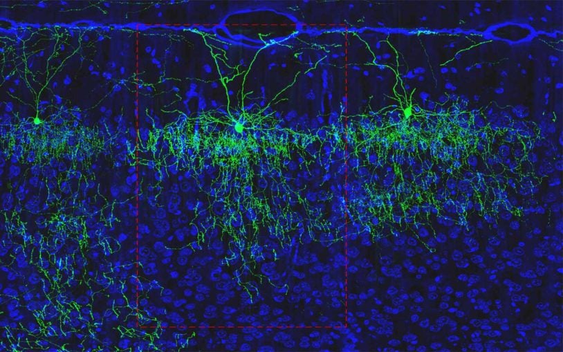 axo-axonic cell mouse brain