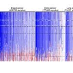 Chromosome 8p deletion