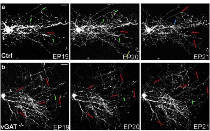 GABA signaling prunes back copious ‘provisional’ synapses during neural circuit assembly