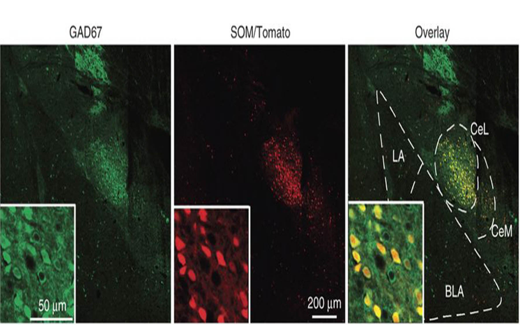 GAD67 antibody coronal brain