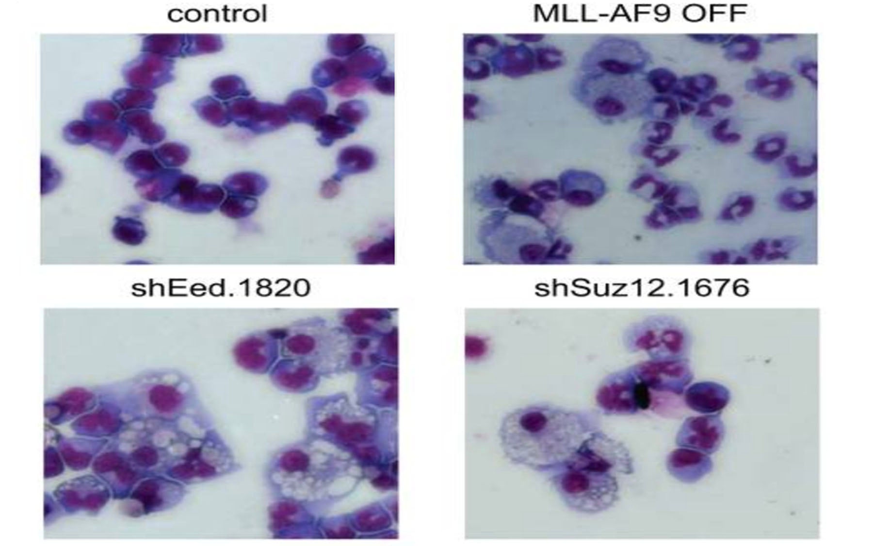 MLL-AF9 light microscopy