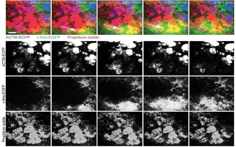 Myeloid cell infiltration dynamics