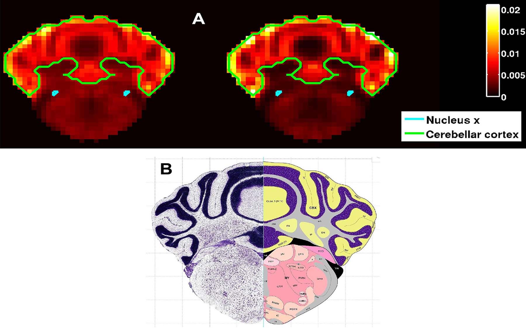 Analysis of 26 networked autism genes suggests functional role in the cerebellum - Cold Spring Harbor Laboratory