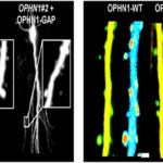 OPHN1-WT and OPHN1-GAP