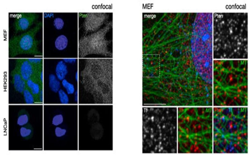 Study revises standard theory of how PTEN, a critical tumor suppressor, shuts off growth signals