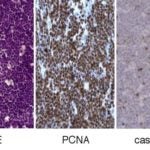 RNAi in vivo lymphoma model