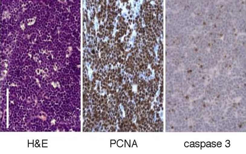 RNAi in vivo lymphoma model