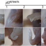 Range of limb deformities