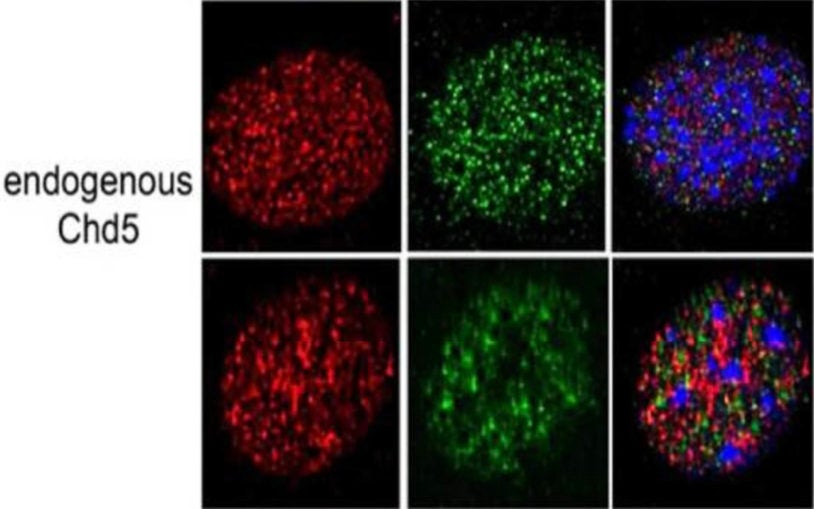 Cancer scientists determine mechanism of one of the most powerful tumor-suppressor proteins, Chd5