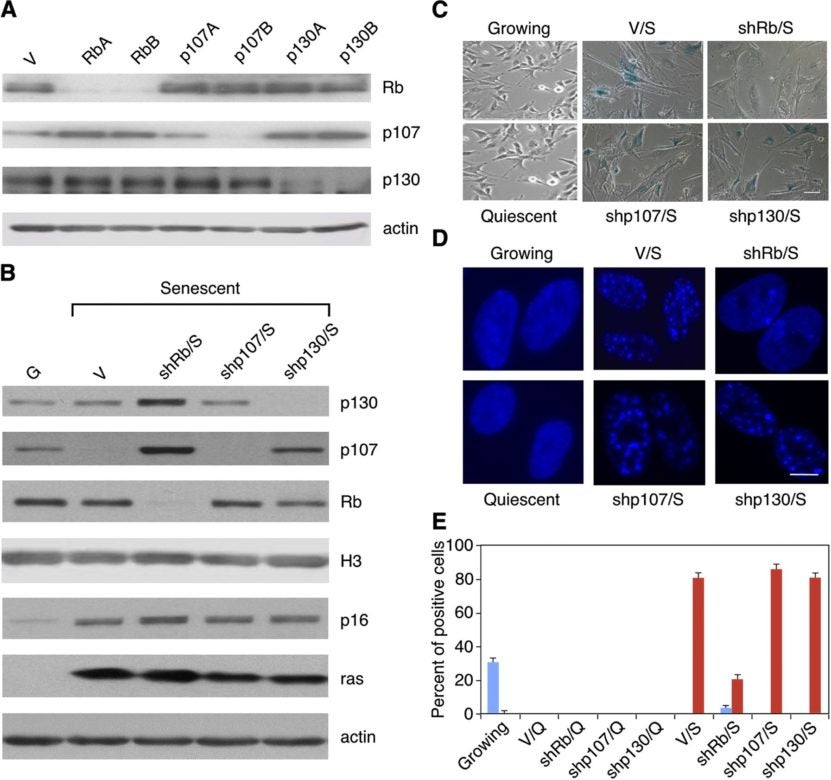 RNAi mediated knockdown of retinoblastoma