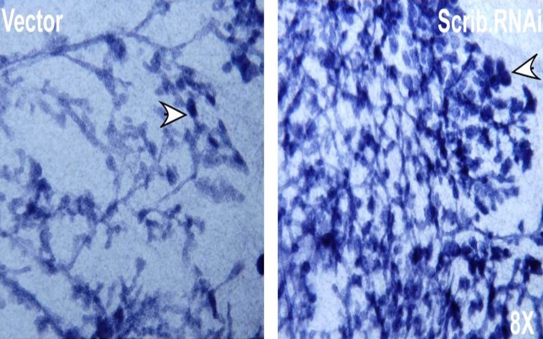 mammary outgrowth GFP