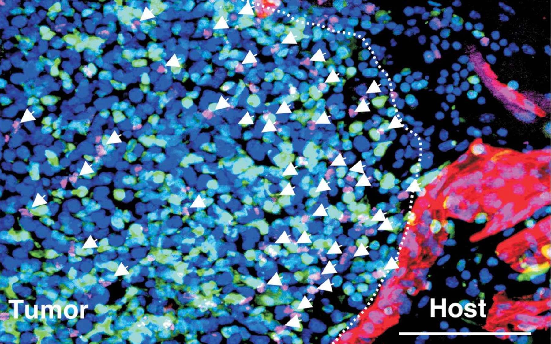 BM derived EPCs spontaneous breast tumors